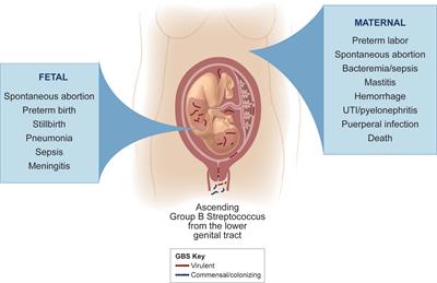 Bacterial and Host Determinants of Group B Streptococcal Vaginal Colonization and Ascending Infection in Pregnancy